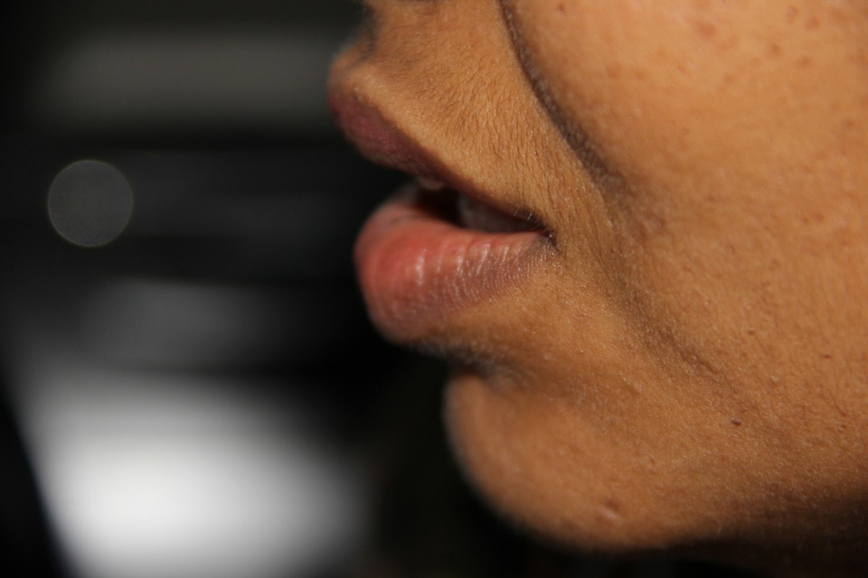 Creme gegen lippenfältchen - Bewundern Sie dem Testsieger